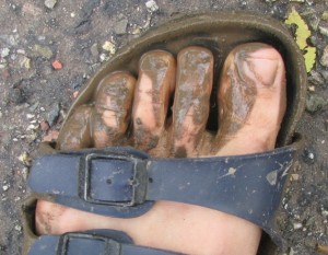 Beblubberde tenen in sandaal